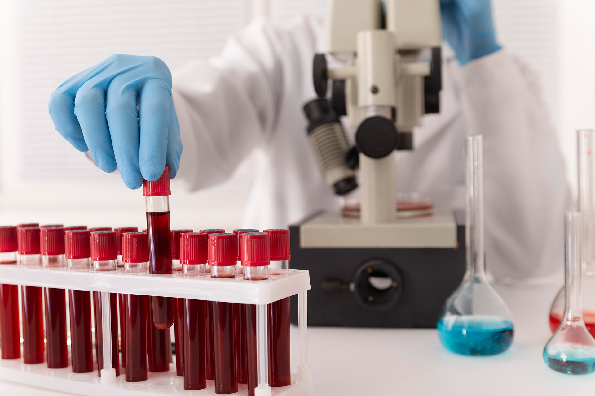 laboratorijske analize